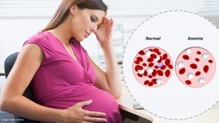 Women’s Infertility And Anemia
